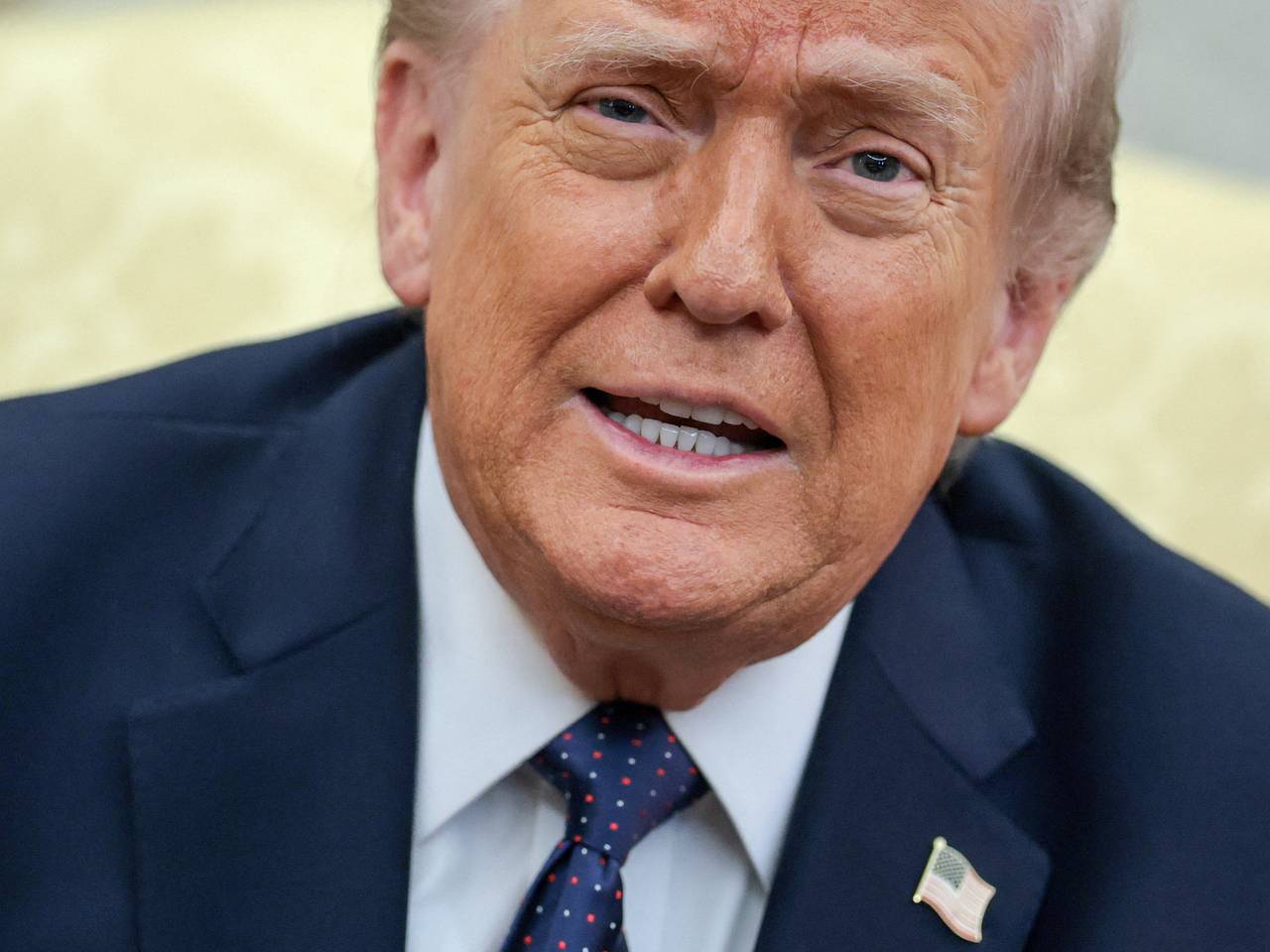 Трампу поставили серьезный диагноз