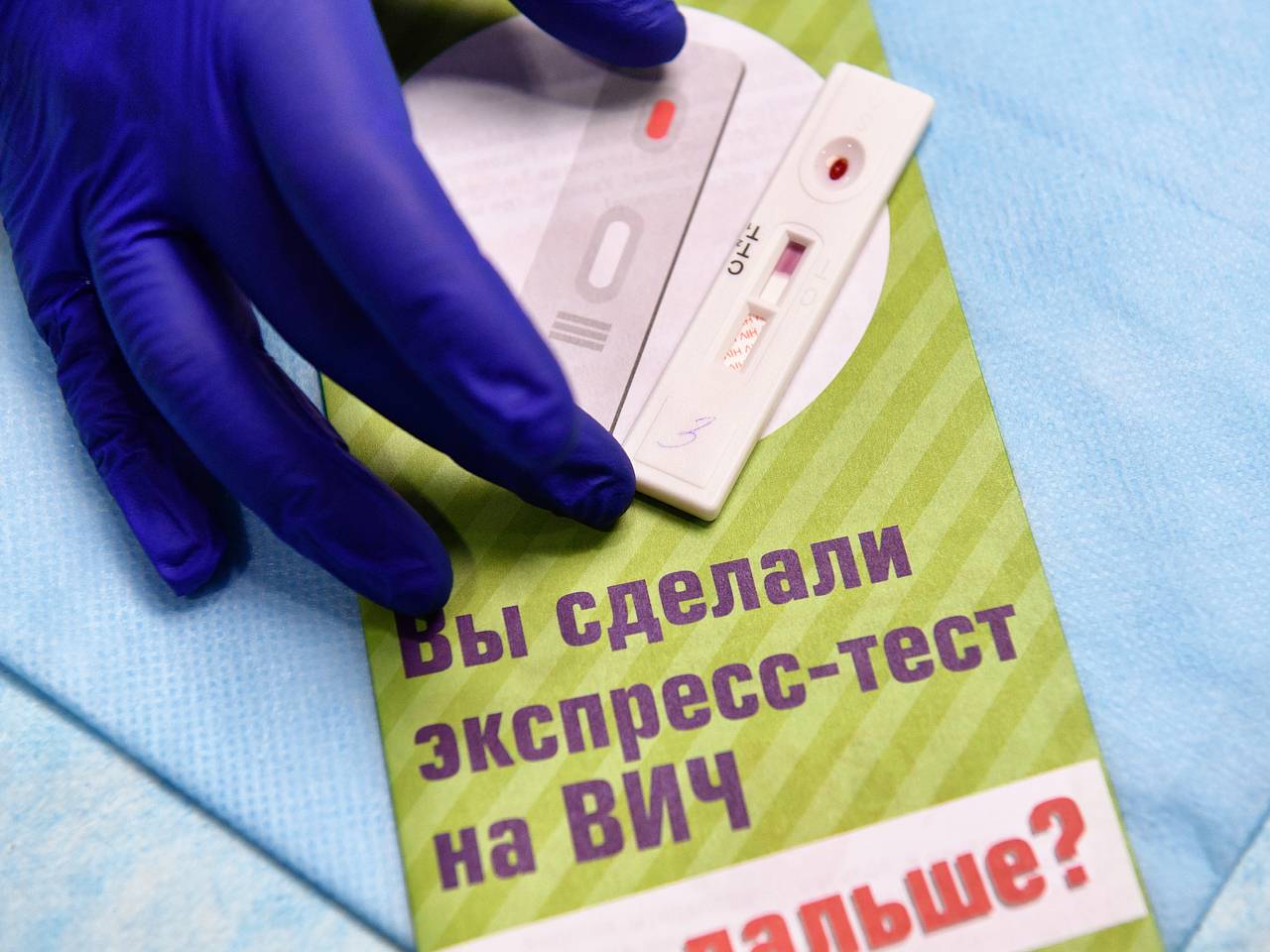 В Московской области увеличилось количество проведенных проверочных тестов на ВИЧ-статус