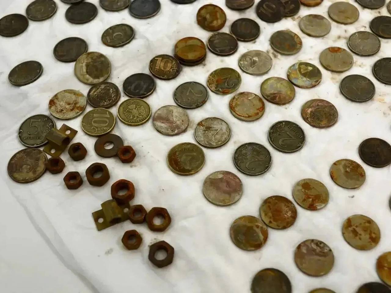 Российские врачи удивились необычной находке в желудке 50-летнего мужчины